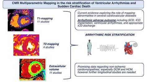 Arrhythmic Risk Stratification by Cardiovascular Magnetic .